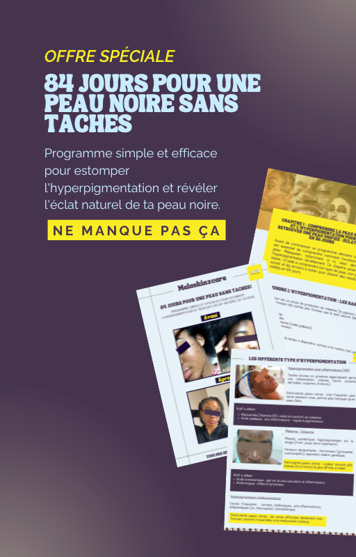 E-book: 84 jours pour une peau noire sans taches - Programme simple et efficace pour estomper durablement de l'hyperpigmentation, unifier ton teint et révéler l'éclat naturel de ta peau